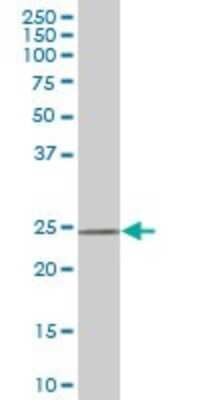 Western Blot: DCUN1D1 Antibody (4B5) [H00054165-M02]