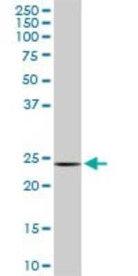 Western Blot: DCUN1D1 Antibody (4B5) [H00054165-M02]