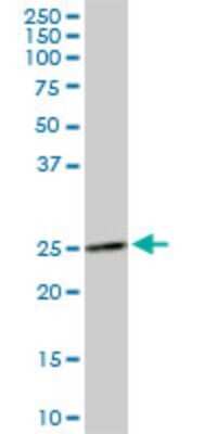 Western Blot: DCUN1D1 Antibody (4B5) [H00054165-M02]