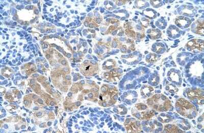 Immunohistochemistry-Paraffin: DCUN1D1 Antibody [NBP1-56537]