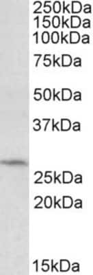 Western Blot: DCUN1D1 Antibody [NBP1-52025]