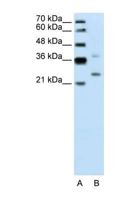 Western Blot: DCUN1D1 Antibody [NBP1-56537]