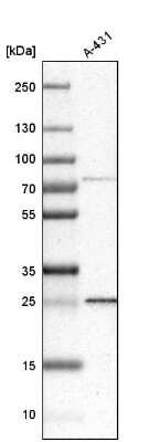 Western Blot: DCUN1D1 Antibody [NBP1-85275]