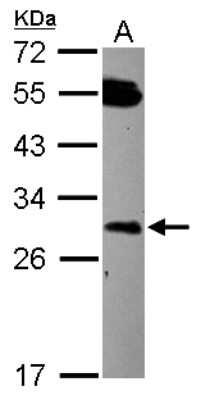 Western Blot: DCUN1D2 Antibody [NBP2-16118]