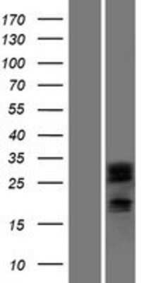 Western Blot: DCUN1D2 Overexpression Lysate [NBP2-08733]