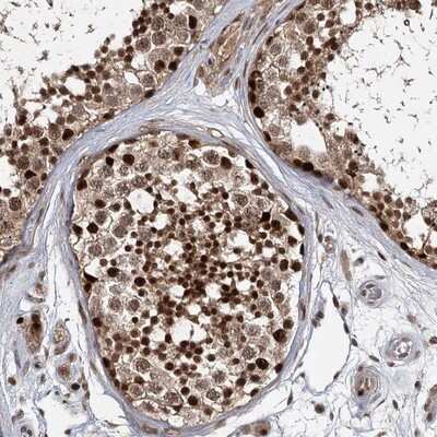 Immunohistochemistry-Paraffin: DCUN1D4 Antibody [NBP1-81526]