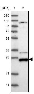 Western Blot: DCUN1D4 Antibody [NBP1-81526]