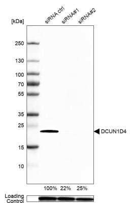 Western Blot: DCUN1D4 Antibody [NBP1-81526]