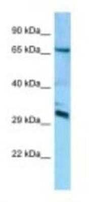 Western Blot: DCUN1D4 Antibody [NBP1-98384]