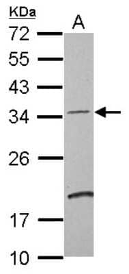 Western Blot: DCUN1D4 Antibody [NBP2-16119]