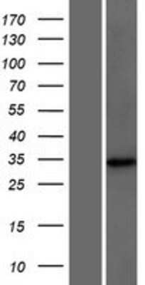 Western Blot: DCUN1D4 Overexpression Lysate [NBP2-08510]