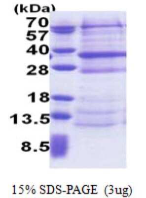 SDS-PAGE: Recombinant Human DCUN1D4 His Protein [NBP2-22988]