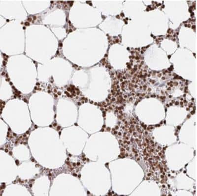 Immunohistochemistry: DCUN1D5 Antibody [NBP2-30432]