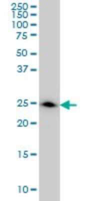 Western Blot: DCXR Antibody (6A6) [H00051181-M03]