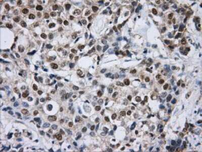 Immunohistochemistry-Paraffin: DCXR Antibody (OTI7D11) [NBP2-02192]