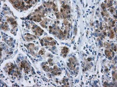 Immunohistochemistry-Paraffin: DCXR Antibody (OTI7D11) [NBP2-02192]