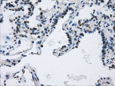 Immunohistochemistry-Paraffin: DCXR Antibody (OTI7D11) [NBP2-02192]