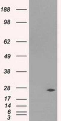 Western Blot: DCXR Antibody (OTI7D11) [NBP2-02192]