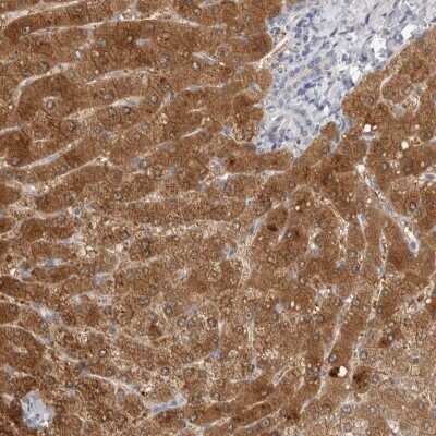 Immunohistochemistry-Paraffin: DCXR Antibody [NBP1-85279]