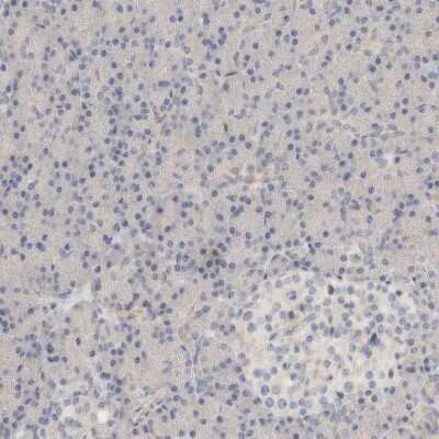 Immunohistochemistry-Paraffin: DCXR Antibody [NBP1-85279]