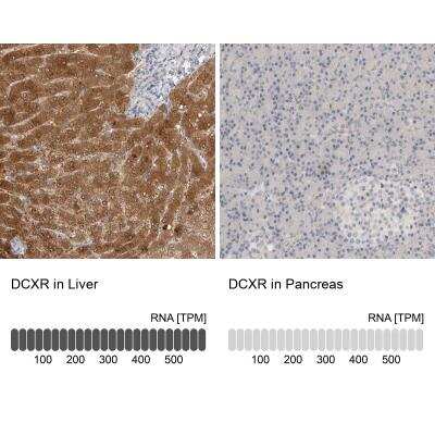 Immunohistochemistry-Paraffin: DCXR Antibody [NBP1-85279]