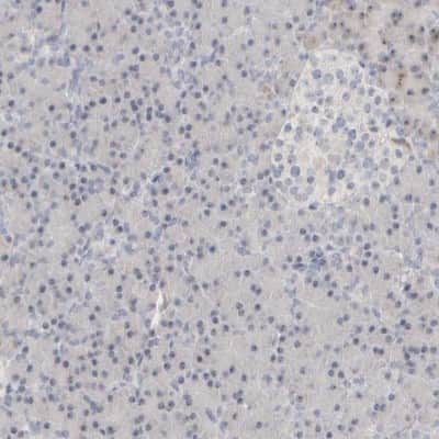 Immunohistochemistry-Paraffin: DCXR Antibody [NBP1-85280]