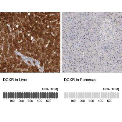 Immunohistochemistry-Paraffin: DCXR Antibody [NBP1-85280]