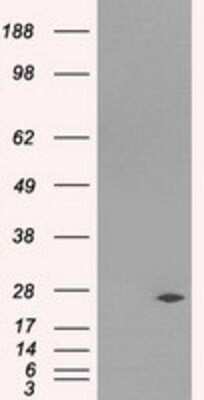 Western Blot: DCXR Antibody (OTI7D11)Azide and BSA Free [NBP2-71906]