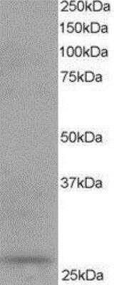 Western Blot: DCXR Antibody [NB100-1068]