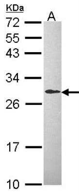 Western Blot: DCXR Antibody [NBP1-31507]