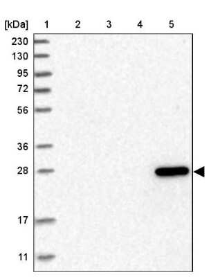 Western Blot: DCXR Antibody [NBP1-85279]