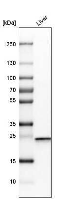 Western Blot: DCXR Antibody [NBP1-85280]