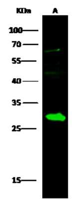 Western Blot: DCXR Antibody [NBP3-00319]