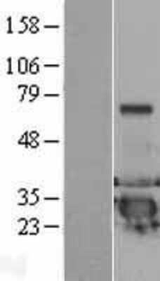 Western Blot: DCXR Overexpression Lysate [NBL1-09762]