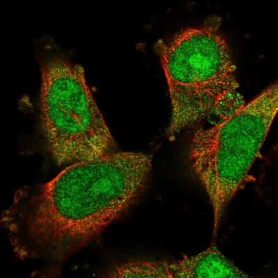 Immunocytochemistry/ Immunofluorescence: DDA1 Antibody [NBP2-58470]