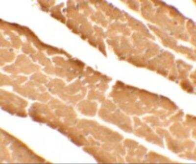 Immunohistochemistry: DDA1 Antibody - BSA Free [NBP2-81982]