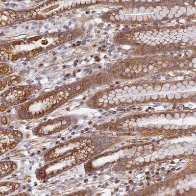 Immunohistochemistry-Paraffin: DDA1 Antibody [NBP1-89891]