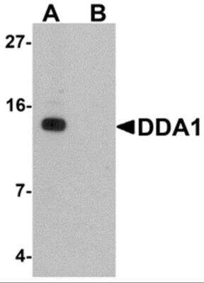 Western Blot: DDA1 AntibodyBSA Free [NBP2-81982]