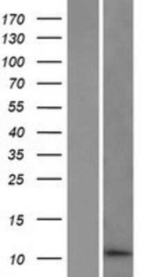 Western Blot: DDA1 Overexpression Lysate [NBP2-06359]