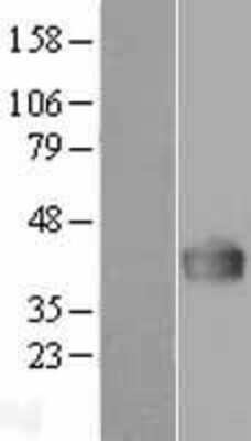 Western Blot: Dimethylarginine Dimethylaminohydrolase 1/DDAH1 Overexpression Lysate [NBP2-04327]