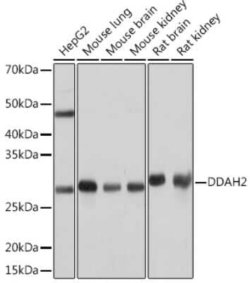 Western Blot: DDAH2 Antibody (5M4Y4) [NBP3-16345]