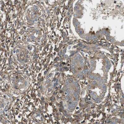 Immunohistochemistry-Paraffin: DDAH2 Antibody [NBP1-86092]