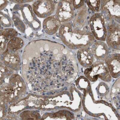 Immunohistochemistry-Paraffin: DDAH2 Antibody [NBP1-86092]