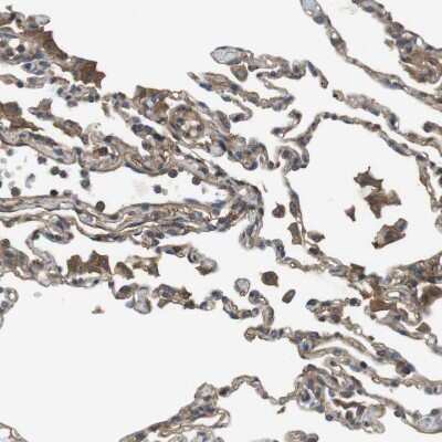 Immunohistochemistry-Paraffin: DDAH2 Antibody [NBP1-86092]