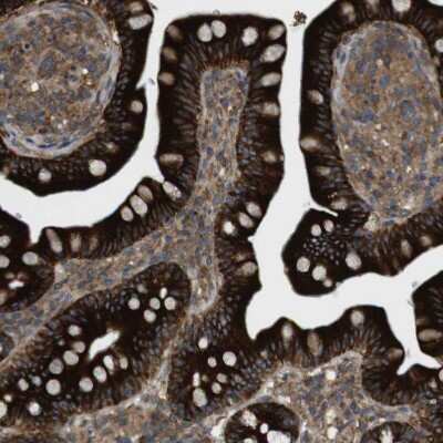 Immunohistochemistry-Paraffin: DDAH2 Antibody [NBP1-86092]