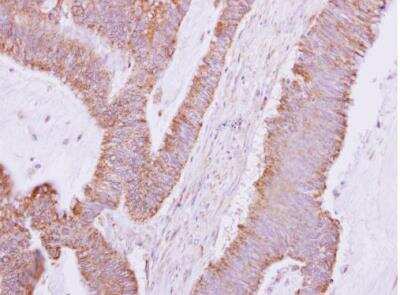 Immunohistochemistry-Paraffin: DDAH2 Antibody [NBP2-16121]