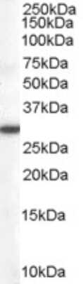 Western Blot: DDAH2 Antibody [NB100-864]