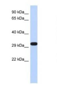 Western Blot: DDAH2 Antibody [NBP1-58859]