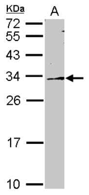 Western Blot: DDAH2 Antibody [NBP2-16121]