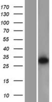 Western Blot: DDAH2 Overexpression Lysate [NBP2-07399]